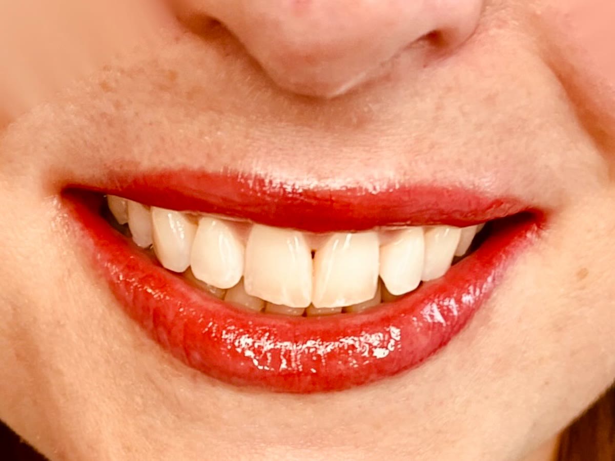 Lippen nach einer Pigmentierung in einem kräftigen Rot